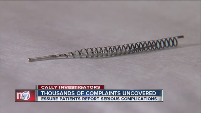 Patients Report Serious Side Effects From Essure