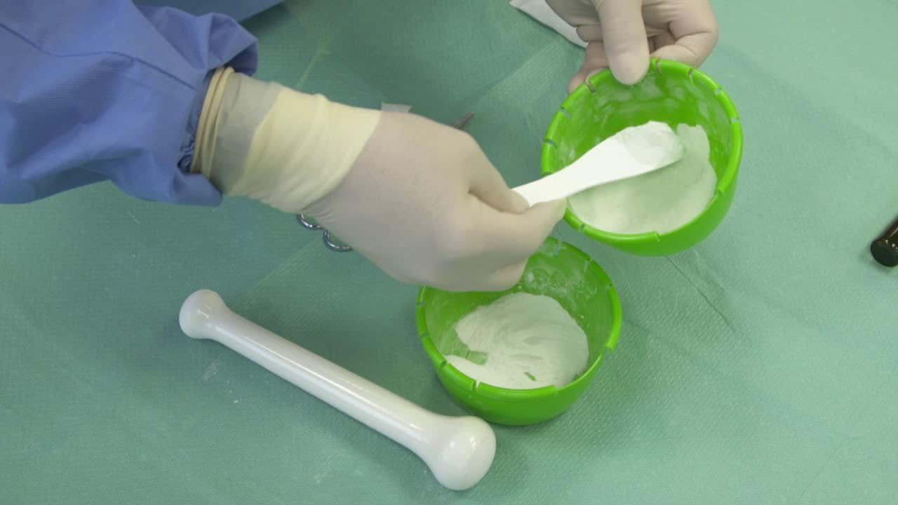 Bone Cement Lawsuit Bone Cement Implantation Syndrome, Revision Lawyers