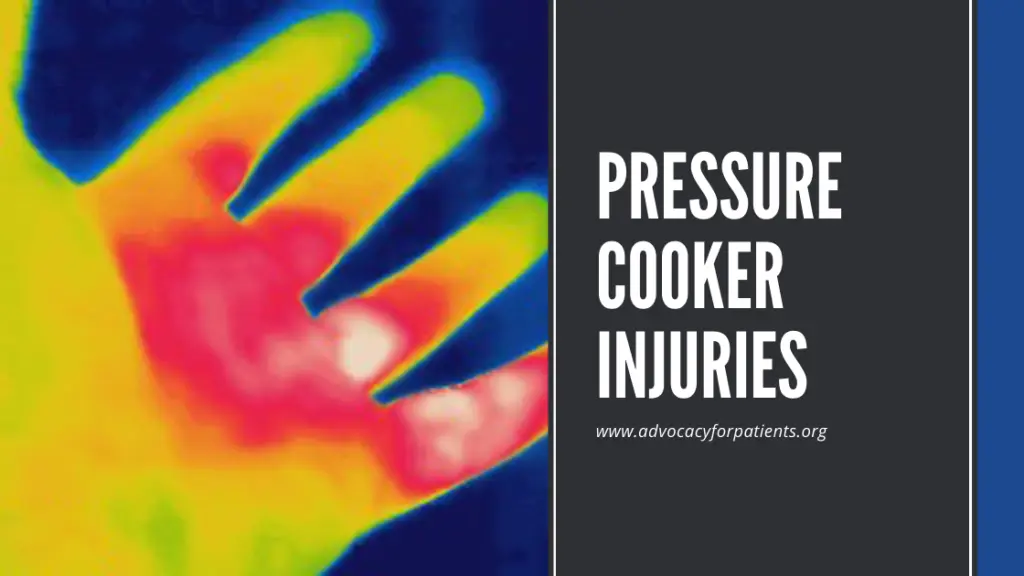 pressure cooker injuries